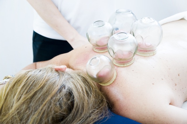 Cupping Therapy